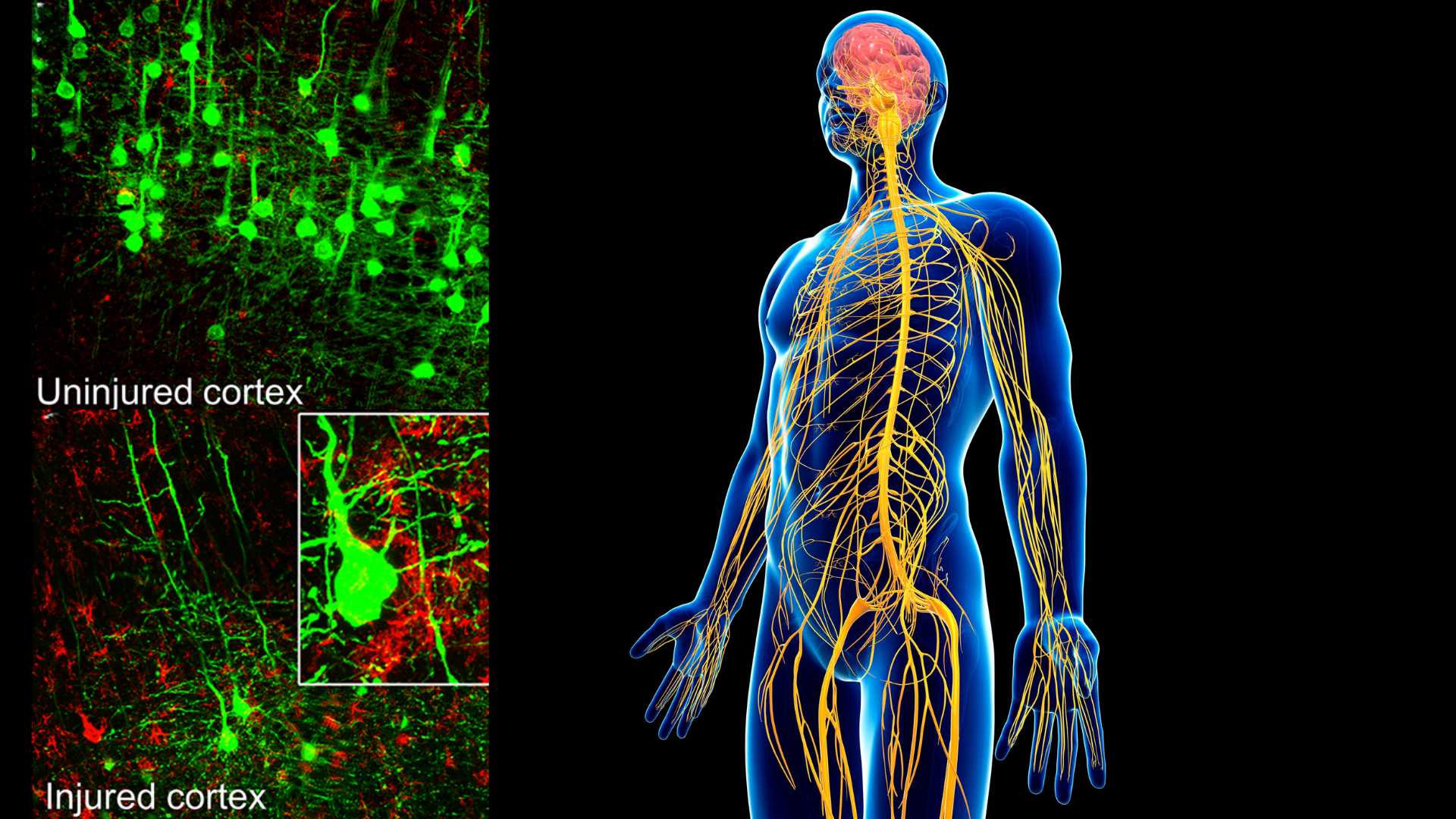 When distance matters for nerve cell repair after a spinal cord injury